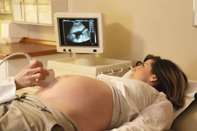 arztbesuch schwangerschaft arbeitszeit - Wie viel Stunden pro Tag darf eine Schwangere arbeiten