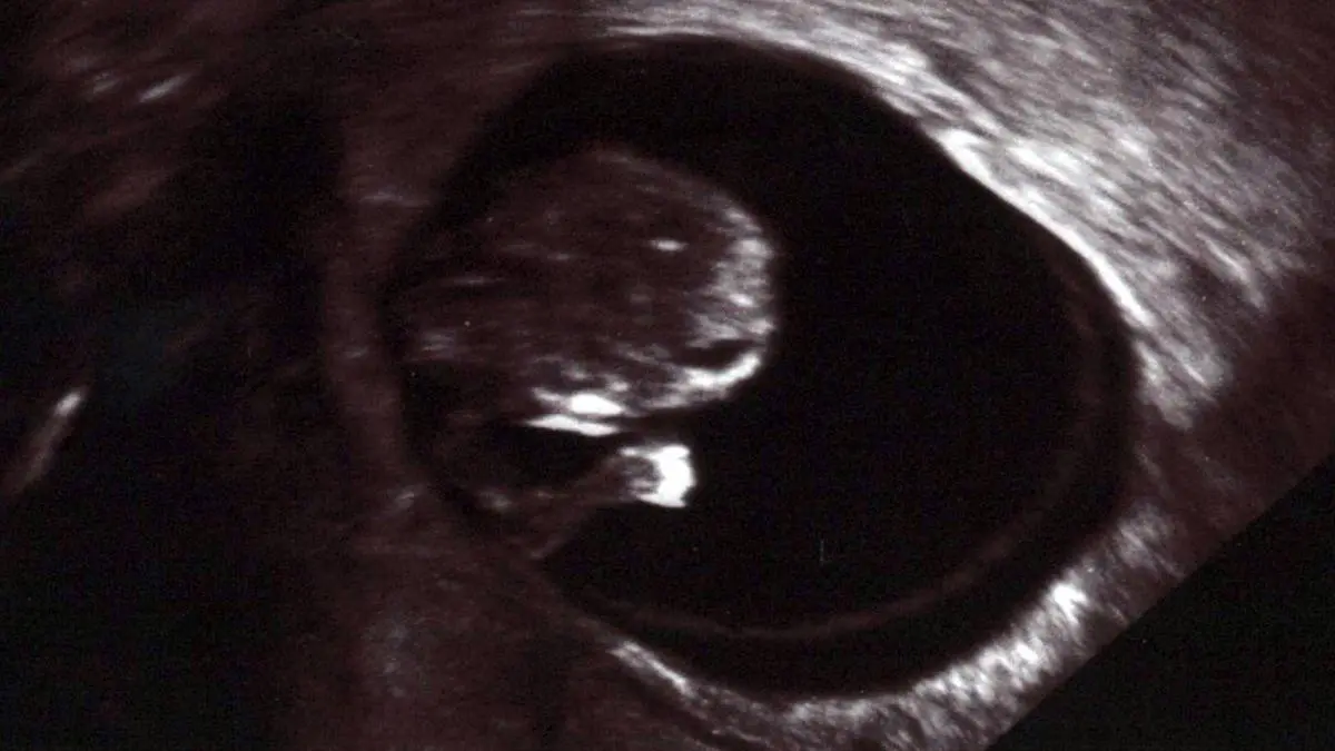 abgänge schwangerschaft - Wie viele Abgänge sind normal