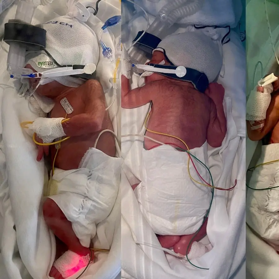 geburt hamburg - Wie viele Kinder werden jährlich in Hamburg geboren