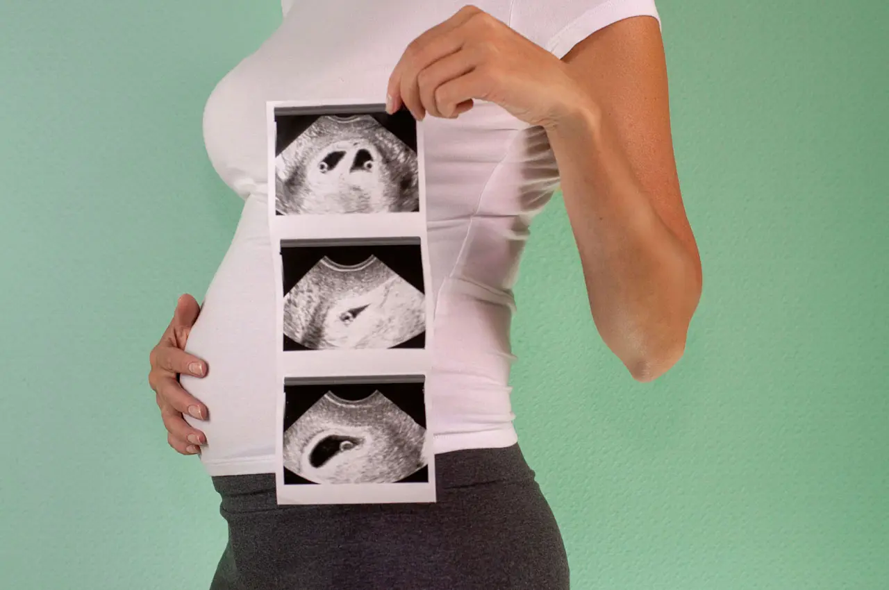 erstes screening schwangerschaft - Wird das Ersttrimester-Screening über den Bauch gemacht
