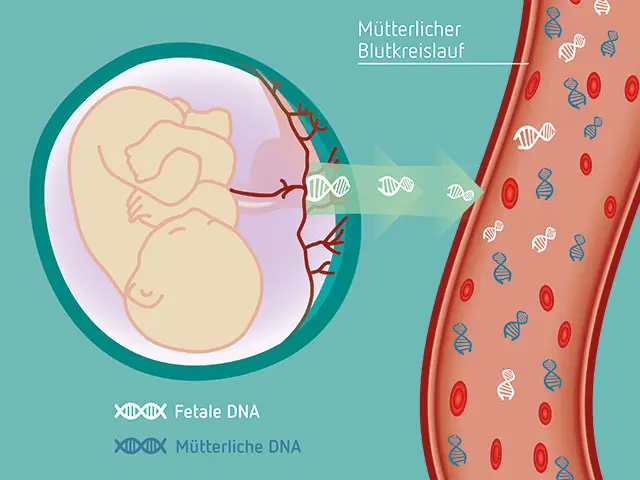 NIPT Test in der Schwangerschaft: Alles, was Sie wissen müssen - Wird der NIPT Test von der Krankenkasse übernommen nipt test schwangerschaft - Wird der NIPT Test von der Krankenkasse übernommen