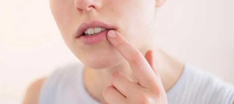 herpes bei der geburt - Wird Herpes bei der Geburt übertragen