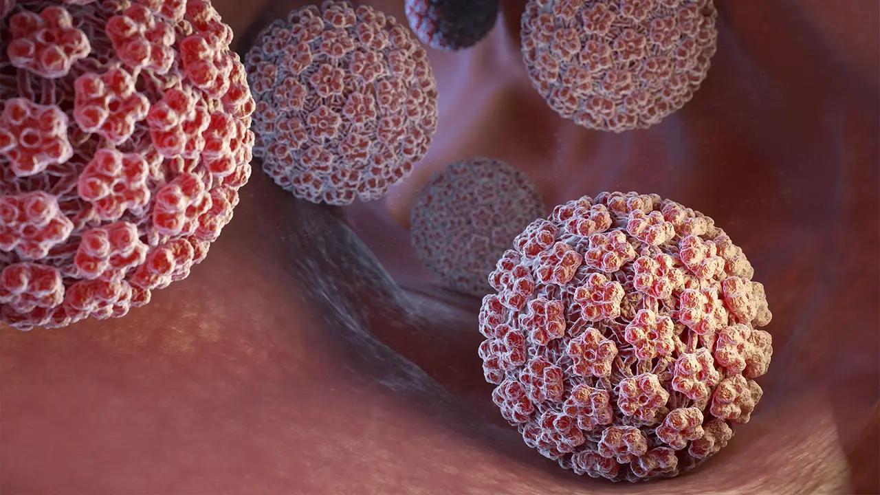 hpv geburt - Wird HPV bei der Geburt übertragen