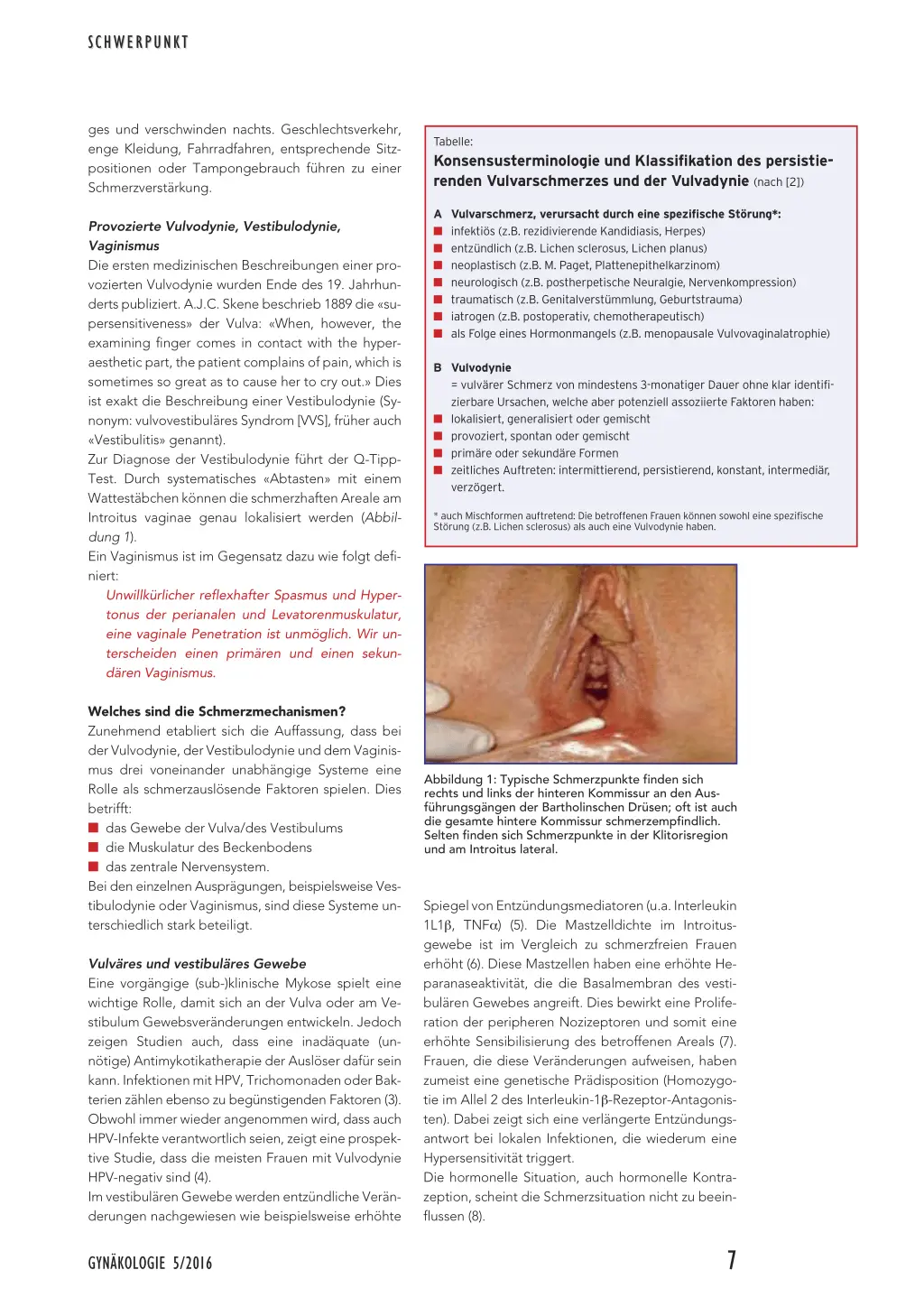 lichen sclerosus geburt - Wird Lichen sclerosus vererbt
