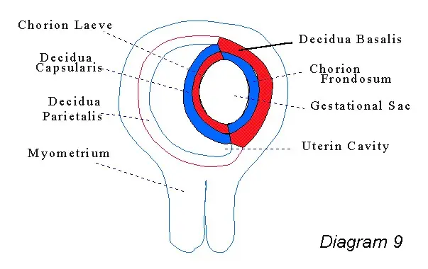chorion frondosum - Wo sind die Chorionzotten