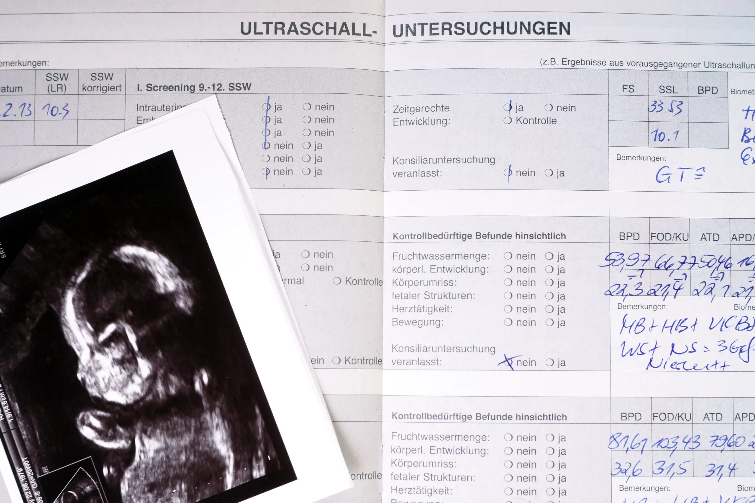 besonderheiten geburt mutterpass - Wo steht die Geburtszeit im Mutterpass