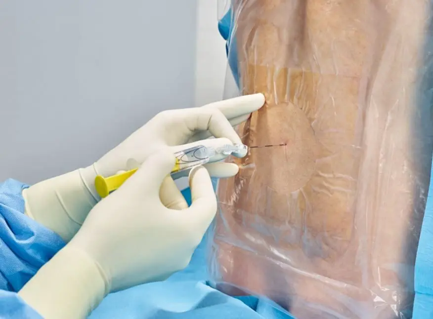 pda spritzen - Wo wird die PDA gespritzt