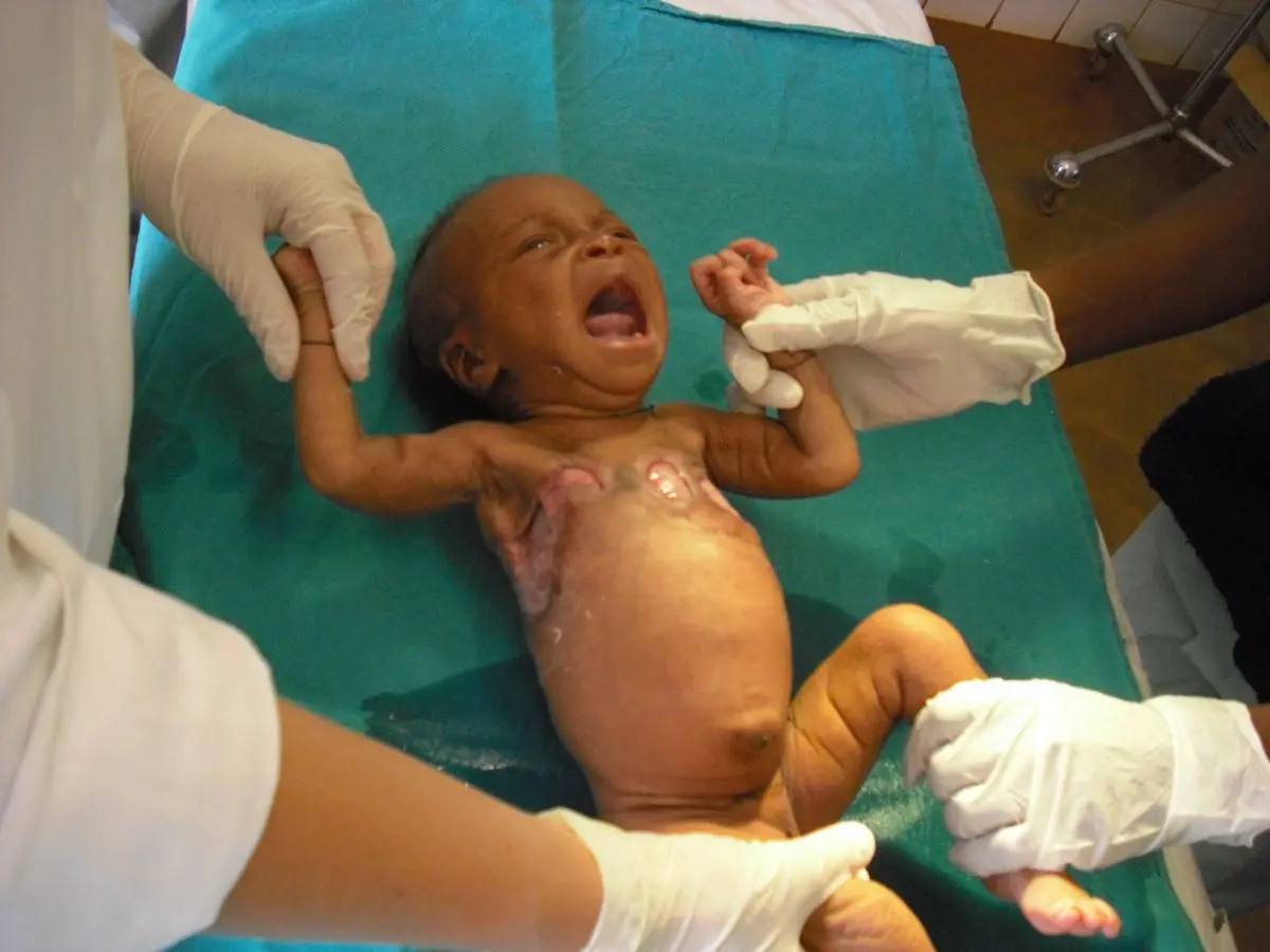 streptokokken geburt - Woher bekommt man B-Streptokokken in der Scheide