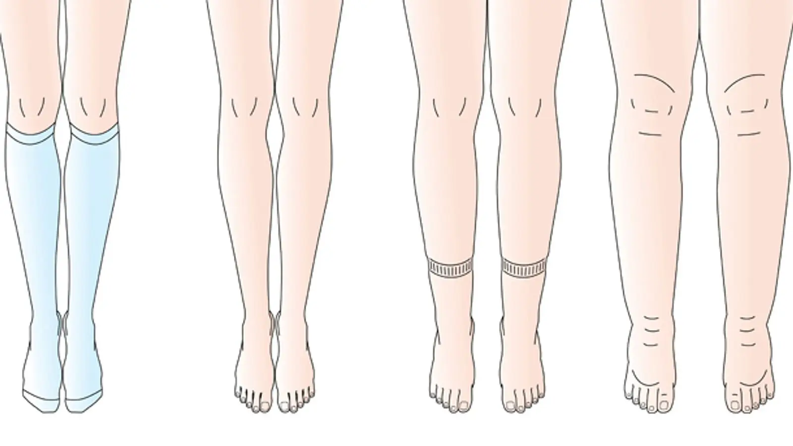 wie erkenne ich wassereinlagerungen - Woher weiß man ob man Wassereinlagerungen hat